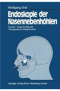 Endoskopie der Nasennebenhohlen