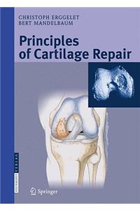 Principles of Cartilage Repair