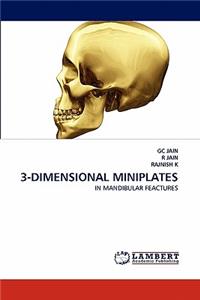 3-Dimensional Miniplates