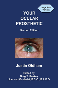 Your Ocular Prosthetic