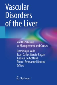 Vascular Disorders of the Liver