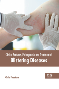 Clinical Features, Pathogenesis and Treatment of Blistering Diseases