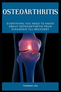 Osteoarthritis