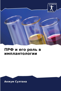 ПРФ и его роль в имплантологии