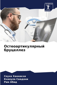 Остеоартикулярный бруцеллез