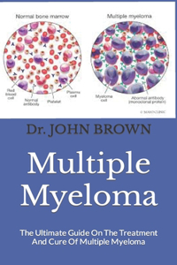 Multiple Myeloma