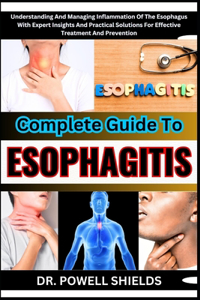 Complete Guide to Esophagitis