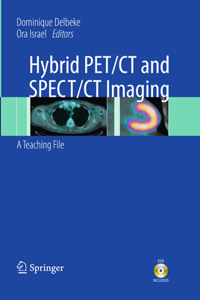 Hybrid Pet/CT and Spect/CT Imaging