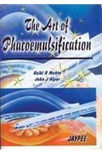 The Art of Phacoemulsification