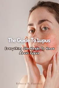 Guide To Lupus