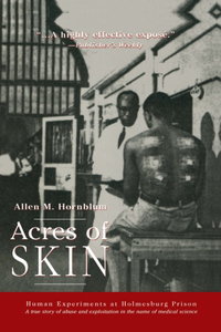 Acres of Skin