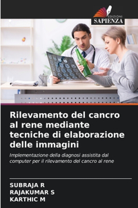 Rilevamento del cancro al rene mediante tecniche di elaborazione delle immagini