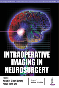 Intraoperative Imaging in Neurosurgery