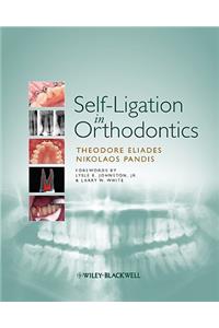 Self-Ligation in Orthodontics