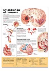 Understanding Stroke Anatomical Chart in Spanish (Entendiendo qué es un derrame)