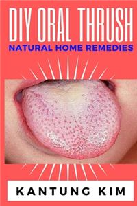 DIY Oral Thrush Natural Home Remedies