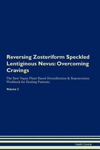 Reversing Zosteriform Speckled Lentiginous Nevus
