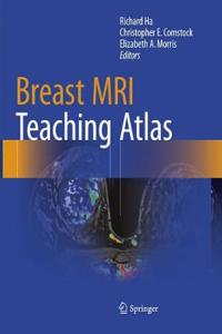 Breast MRI Teaching Atlas