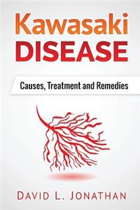 Kawasaki disease - A Slowly Developed Health Issue