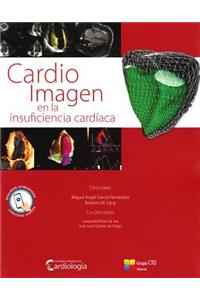 Cardio Imagen En La Insuficiencia Cardiaca