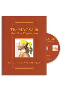 Macs-Lift Short Scar Rhytidectomy