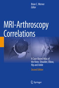 Mri-Arthroscopy Correlations