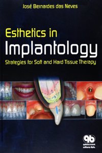 Esthetics in Implantology