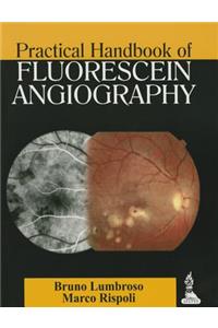 Practical Handbook of Fluorescein Angiography