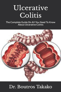 Ulcerative Colitis