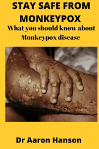 Stay Safe from Monkeypox