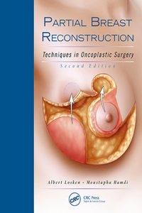 Partial Breast Reconstruction: Techniques in Oncoplastic Surgery