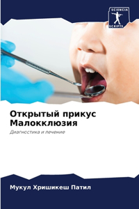 Открытый прикус Малокклюзия