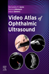 Video Atlas of Ophthalmic Ultrasound - E-Book