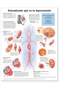 Understanding Hypertension Anatomical Chart in Spanish (Entendiendo Que Es La Hypertension)