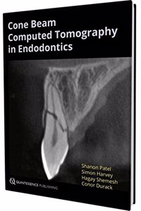 Cone Beam Computed Tomography in Endodontics