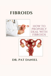 Fibroids