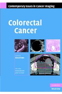 Colorectal Cancer