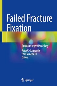 Failed Fracture Fixation