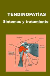 Tendinopatías