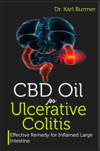CBD Oil for Ulcerative Colitis