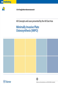 Minimally Invasive Plate Osteosynthesis (MIPO): Concepts and Cases Presented by the AO East Asia