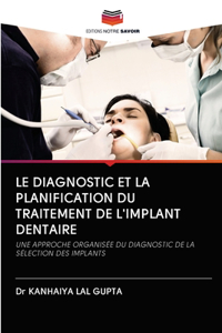 Le Diagnostic Et La Planification Du Traitement de l'Implant Dentaire