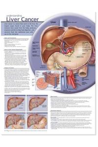 Understanding Liver Cancer Anatomical Chart