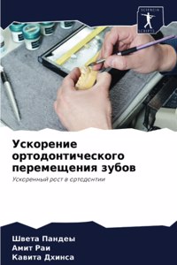 Ускорение ортодонтического перемещения &