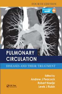 Pulmonary Circulation