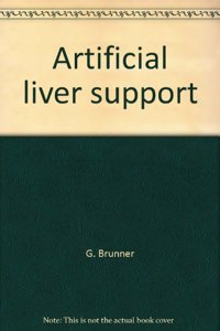 Artificial Liver Support