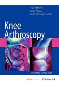 Knee Arthroscopy