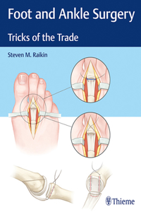 Foot and Ankle Surgery