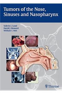 Tumors of the Nose, Sinuses and Nasopharynx