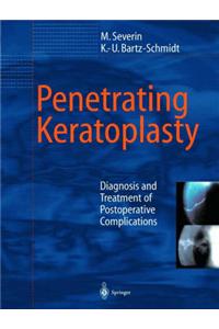 Penetrating Keratoplasty